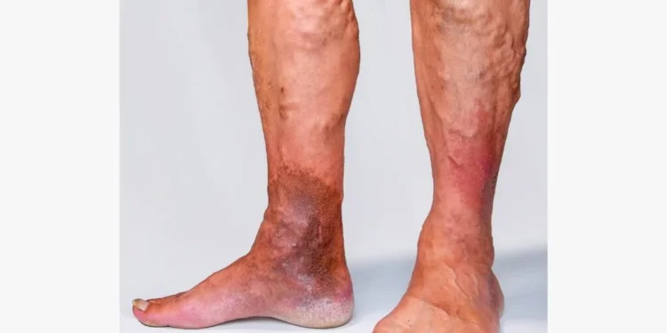 credit: medicalnewstoday