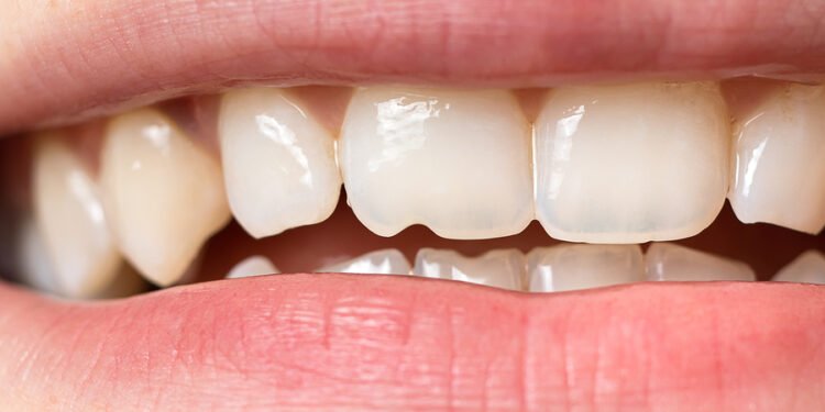 credit: hovedentalclinic.co.uk