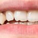 credit: hovedentalclinic.co.uk