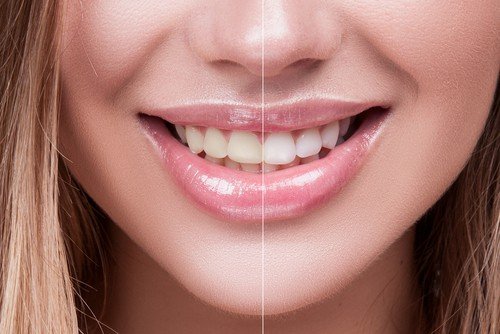 credit: rockymountdentalarts