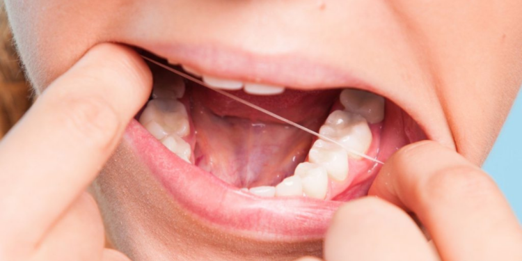 Can Food Stuck In Teeth Cause Pain