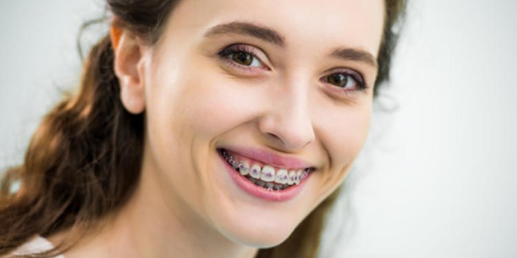 Can You Get Braces With Periodontal Disease