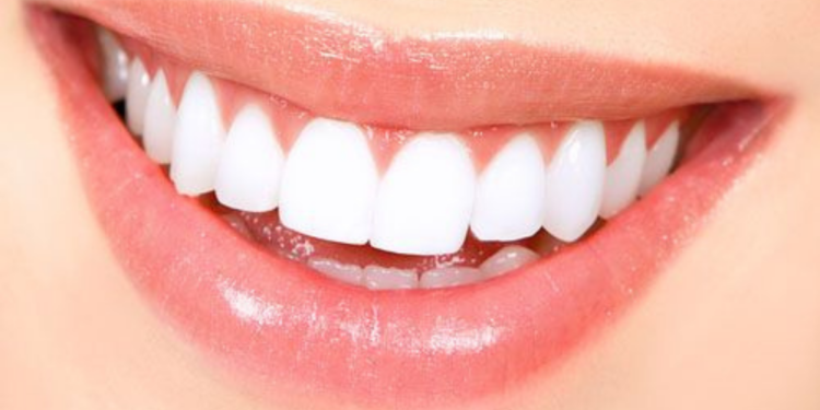 How To Whiten Fake Teeth