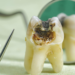 Does Grinding Teeth Cause Cavities