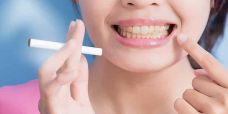 How To Remove Tobacco Stains From Teeth Instantly